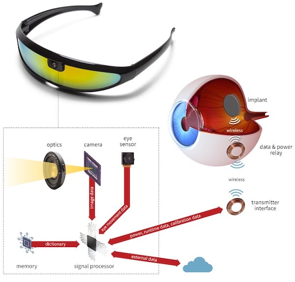 Stanford’s system for an artificial retina, which shares characteristic design elements to alternatives, such as glasses with a built-in camera, processing capability, and wireless transfer to the retina. 